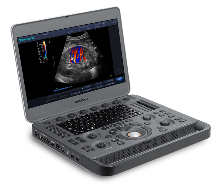 Ecógrafo Portátil SONOSCAPE X3 - SH Soluciones Hospitalarias -  Comercialización de equipos médicos